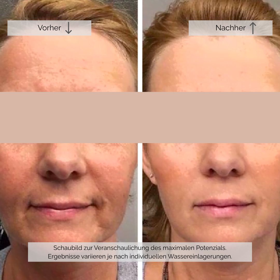Kostral Definition Maske